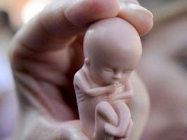 
	Un fetus mumificat, extras dupa 30 de ani din pantecele unei femei &nbsp;
