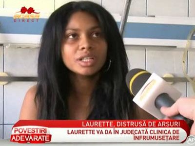 
	Laurette voia sa scape de vergeturi, dar a ajuns la spital cu arsuri de gradul 1 si 2 - VIDEO
