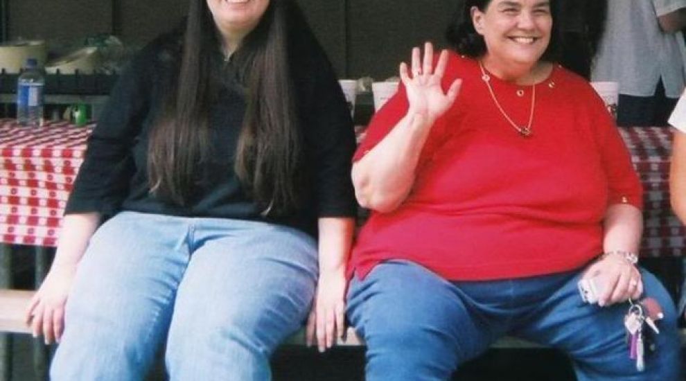 
	Mama se pregatea de operatie de liposuctie, fiica avea 118 kilograme. Cum arata femeile dupa ce s-au motivat una pe cealalta sa tina dieta
