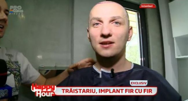 
	Transplantul de par a fost un succes. Lui Mihai Traistariu i-a crescut foarte mult parul si nu mai stie cum sa-l aranjeze: FOTO
