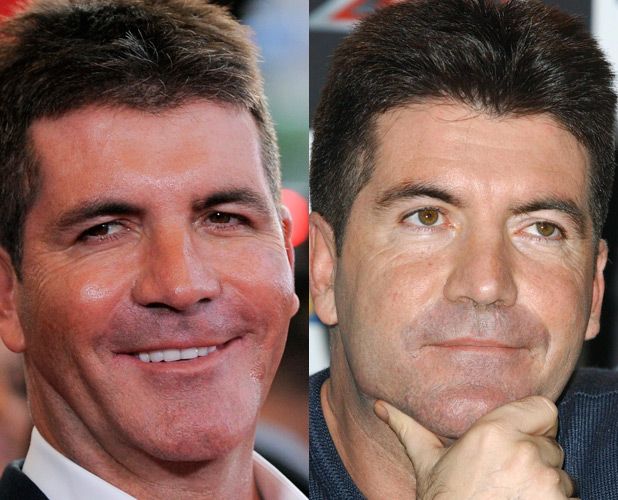 
	Ce se intampla cand barbatii apeleaza la Botox. Simon Cowell, juratul de la &quot;Britain&#39;s Got Talent&quot;, abia isi mai misca fata
