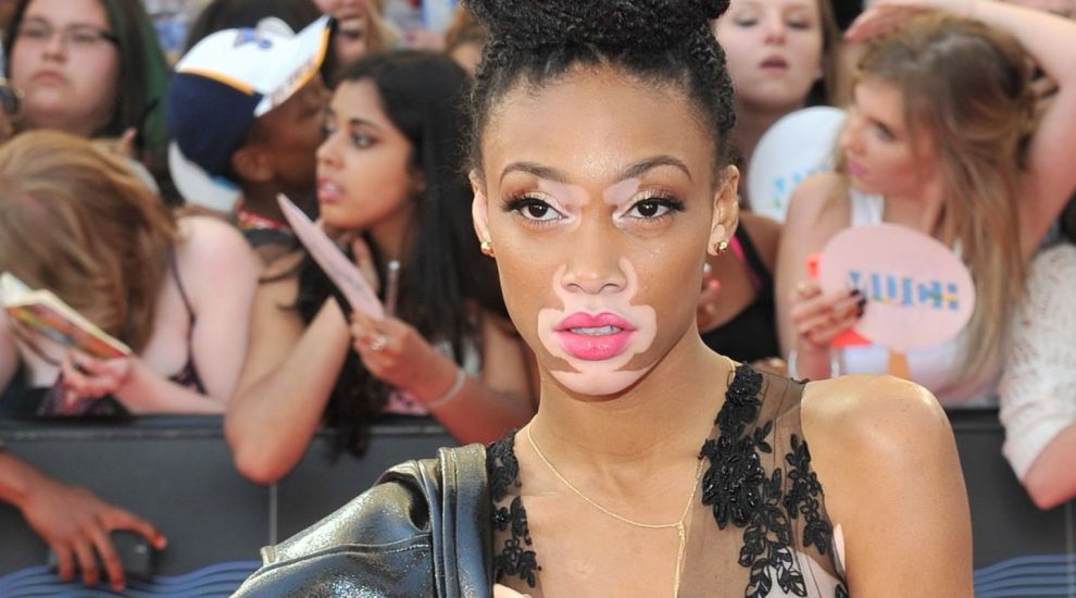 Winnie Harlow este complet diferita fata de alte modele. Imaginile care vor schimba modul in care iti apreciezi trupul