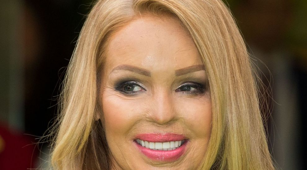 &quot;Sper sa fie ultima operatie&quot;. Ce s-a intamplat cu Katie Piper, femeia care a fost arsa cu acid sufuric pe fata