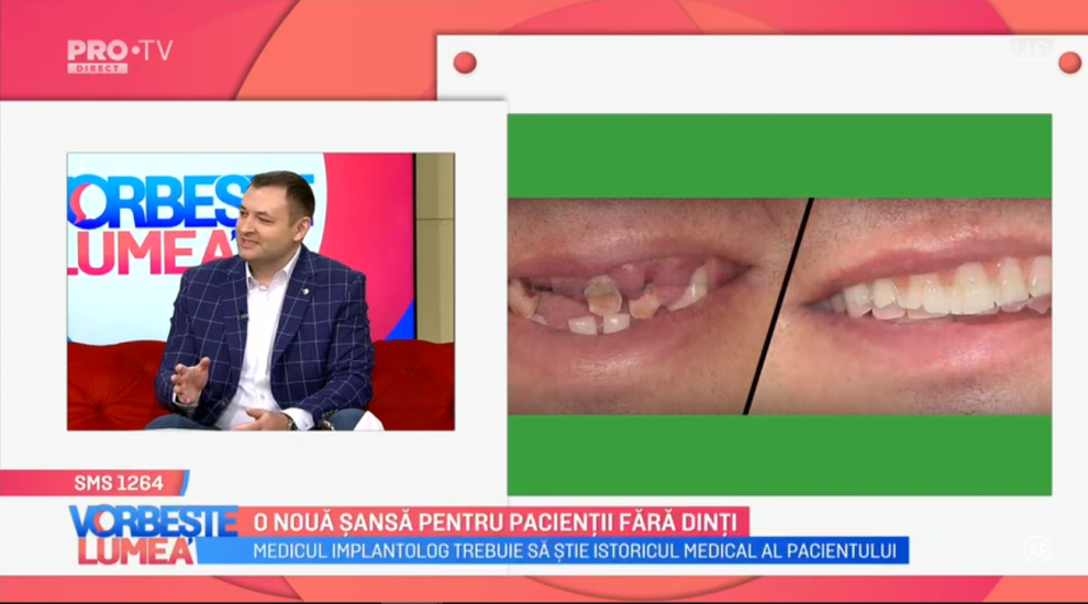 
	VIDEO Dr. Ionuț Leahu, despre implanturile dentare
